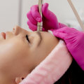 Understanding Microdermabrasion: Your Guide to Aesthetic Skin Treatments