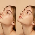 Understanding Revision Rhinoplasty: Enhancing Your Appearance and Addressing Concerns