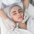 Diamond-tipped microdermabrasion: A Comprehensive Guide to Skin Rejuvenation