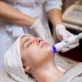 Exploring the Benefits of Nd:YAG Laser Treatments for Skin Rejuvenation