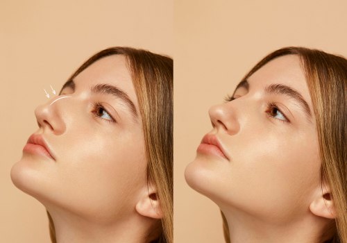 Understanding Revision Rhinoplasty: Enhancing Your Appearance and Addressing Concerns