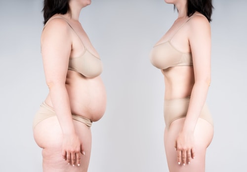 Enhance Your Appearance with Fat Transfer Breast Augmentation