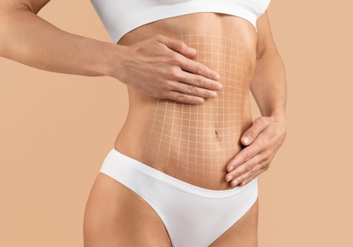 Understanding Tummy Tucks: Enhancing Your Appearance and Addressing Body Concerns