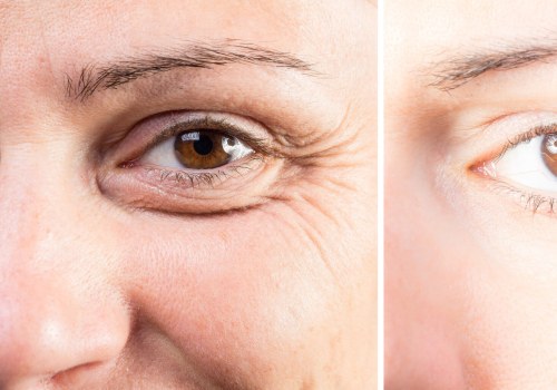 All You Need to Know About Eyelid Surgery: Enhancing Your Appearance and Addressing Skin Concerns